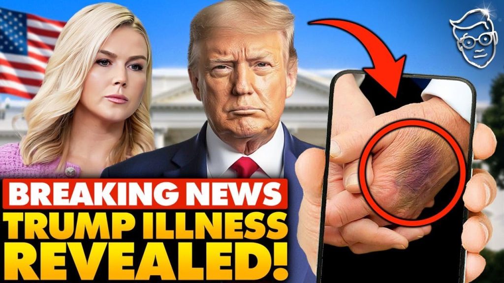White House Makes SHOCK Announcement on Trump’s Health After ‘Bruising’ Photos Go VIRAL: “Doctors.. White House Makes SHOCK Announcement on Trump’s Health After ‘Bruising’ Photos Go VIRAL: “Doctors..